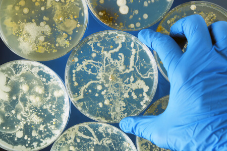 Agar Plates With Bacteria